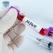 OMS cambiará el nombre de la viruela del mono a mpox