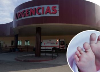 Bebé cayó en olla de comida hirviendo; sufrió quemaduras en la mitad de su cuerpo