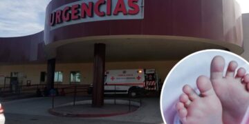 Bebé cayó en olla de comida hirviendo; sufrió quemaduras en la mitad de su cuerpo