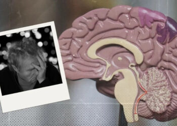 10 señales de que eres propenso a padecer Alzheimer