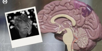 10 señales de que eres propenso a padecer Alzheimer