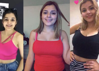 FOTOS: Así lucía Karely Ruiz antes de sus cirugías y rinoplastia