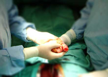 Detienen a dos trabajadores de hospital cubano en posesión de corazones humanos