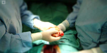 Detienen a dos trabajadores de hospital cubano en posesión de corazones humanos