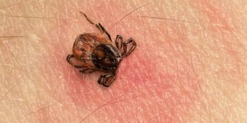 Niña muere tras ser mordida por una garrapata en Nuevo León