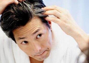 ¿Canas a temprana edad? Pueden ser síntomas de esta enfermedad incurable