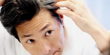 ¿Canas a temprana edad? Pueden ser síntomas de esta enfermedad incurable