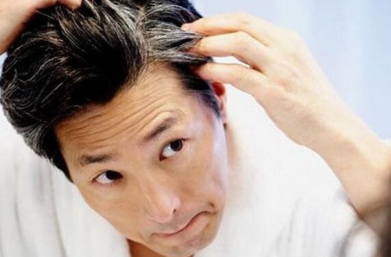 ¿Canas a temprana edad? Pueden ser síntomas de esta enfermedad incurable