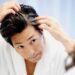 ¿Canas a temprana edad? Pueden ser síntomas de esta enfermedad incurable