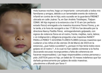 Llevaron a su bebé a una guardería, pero lo regresaron brutalmente golpeado