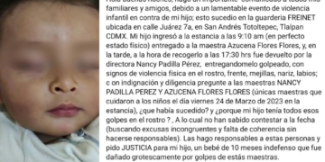 Llevaron a su bebé a una guardería, pero lo regresaron brutalmente golpeado