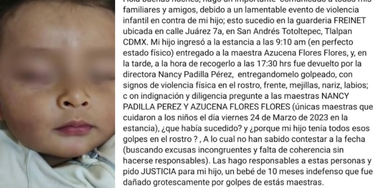 Llevaron a su bebé a una guardería, pero lo regresaron brutalmente golpeado