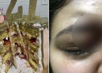 Mujer casi pierde un ojo tras darle mordida a su pastel