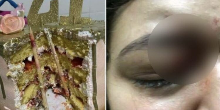 Mujer casi pierde un ojo tras darle mordida a su pastel