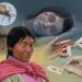 Mal de Chagas, ¿qué es y cómo se transmite?