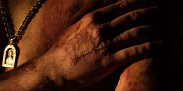 FOTOS: Fotógrafa ucraniana convierte en belleza y respeto los cuerpos mutilados de soldados
