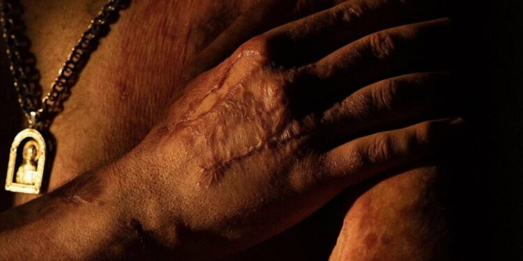 FOTOS: Fotógrafa ucraniana convierte en belleza y respeto los cuerpos mutilados de soldados