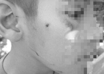 Insultos y agresiones físicas: madre denuncia bullying contra su hijo en primaria del Altiplano