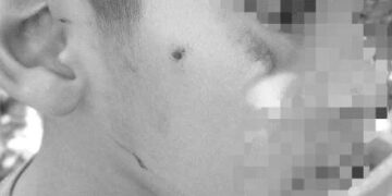 Insultos y agresiones físicas: madre denuncia bullying contra su hijo en primaria del Altiplano