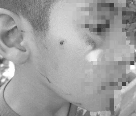 Insultos y agresiones físicas: madre denuncia bullying contra su hijo en primaria del Altiplano