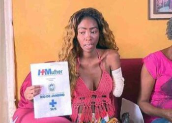 Amputan brazo a guapa bailarina de samba; acusa error médico