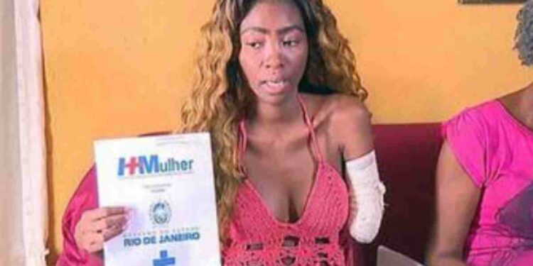 Amputan brazo a guapa bailarina de samba; acusa error médico