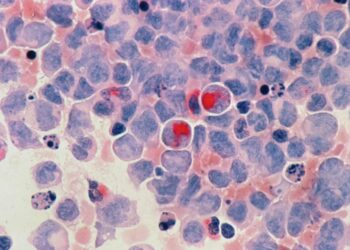 Crean nueva molécula para el tratamiento contra el cáncer