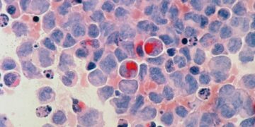 Crean nueva molécula para el tratamiento contra el cáncer