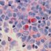 Crean nueva molécula para el tratamiento contra el cáncer