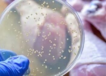 13 personas intoxicadas de salmonella vinculada a mal manejo de los alimentos en Matlapa