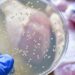 13 personas intoxicadas de salmonella vinculada a mal manejo de los alimentos en Matlapa