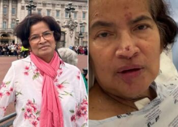 Mujer se va de vacaciones y termina con manos y piernas amputadas por una bacteria