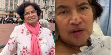 Mujer se va de vacaciones y termina con manos y piernas amputadas por una bacteria