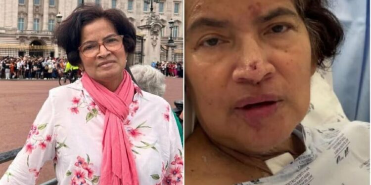 Mujer se va de vacaciones y termina con manos y piernas amputadas por una bacteria