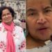 Mujer se va de vacaciones y termina con manos y piernas amputadas por una bacteria