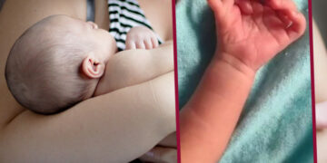 Bebé nace con 26 dedos en manos y pies en la India