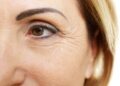 5 trucos para disimular las “patas de gallo” alrededor de los ojos