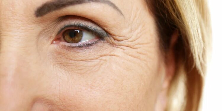 5 trucos para disimular las “patas de gallo” alrededor de los ojos