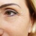 5 trucos para disimular las “patas de gallo” alrededor de los ojos