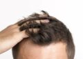 El shampoo para la caída de cabello que cuesta menos de 50 pesos, y es viral en TikTok