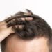 El shampoo para la caída de cabello que cuesta menos de 50 pesos, y es viral en TikTok