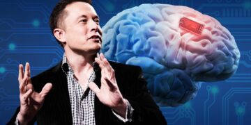 Así funciona el implante cerebral que Elon Musk desarrolló con Neuralink
