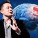 Así funciona el implante cerebral que Elon Musk desarrolló con Neuralink