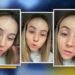 Mujer descubre que tuvo un gusano en el ojo durante 4 años; pensaba que era una “perrilla”
