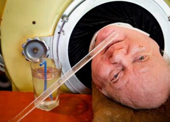 Muere a los 78 años Paul Alexander, el hombre que pasó casi toda su vida dentro de una cápsula de hierro para poder espirar