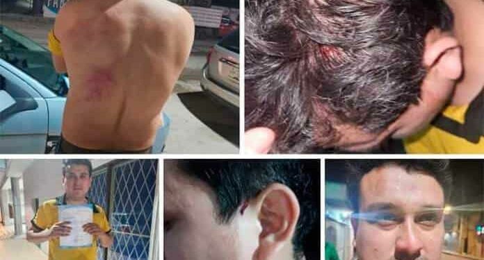 Agrede Tecmol a uno de sus colaboradores