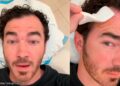 Kevin Jonas se somete a una operación tras diagnóstico de cáncer de piel