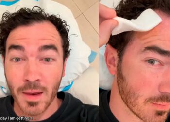 Kevin Jonas se somete a una operación tras diagnóstico de cáncer de piel