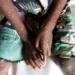 La OMS está tratando de comunicar calma frente al brote de Mpox: ‘No es la Covid’
