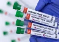 En México no se ha encontrado ningún caso de la nueva variante de la viruela del mono